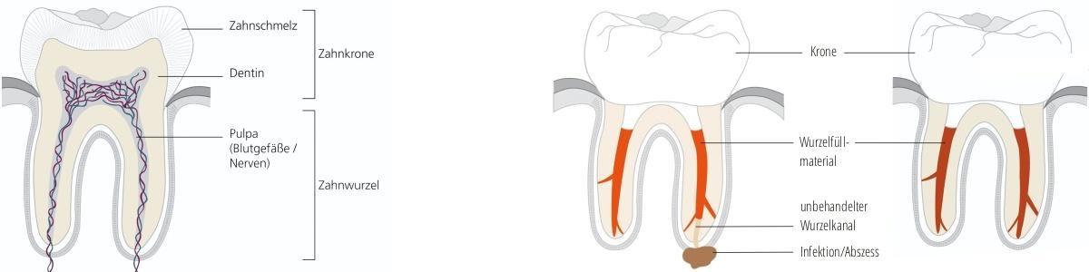 Endodontie/Wurzelbehandlung